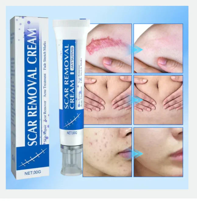 Crème Réparatrice Anti-Cicatrices et Vergeture