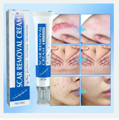 Crème Réparatrice Anti-Cicatrices et Vergeture