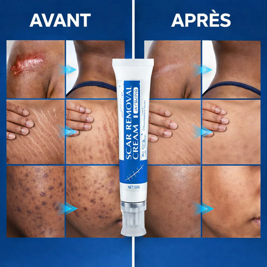 Crème Réparatrice Anti-Cicatrices et Vergeture