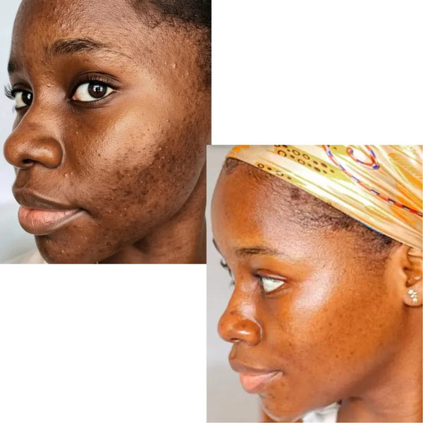 Aïcha D.