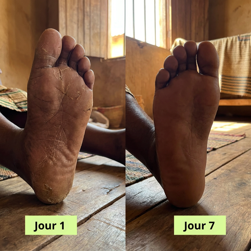 Efficace sur plusieurs zones